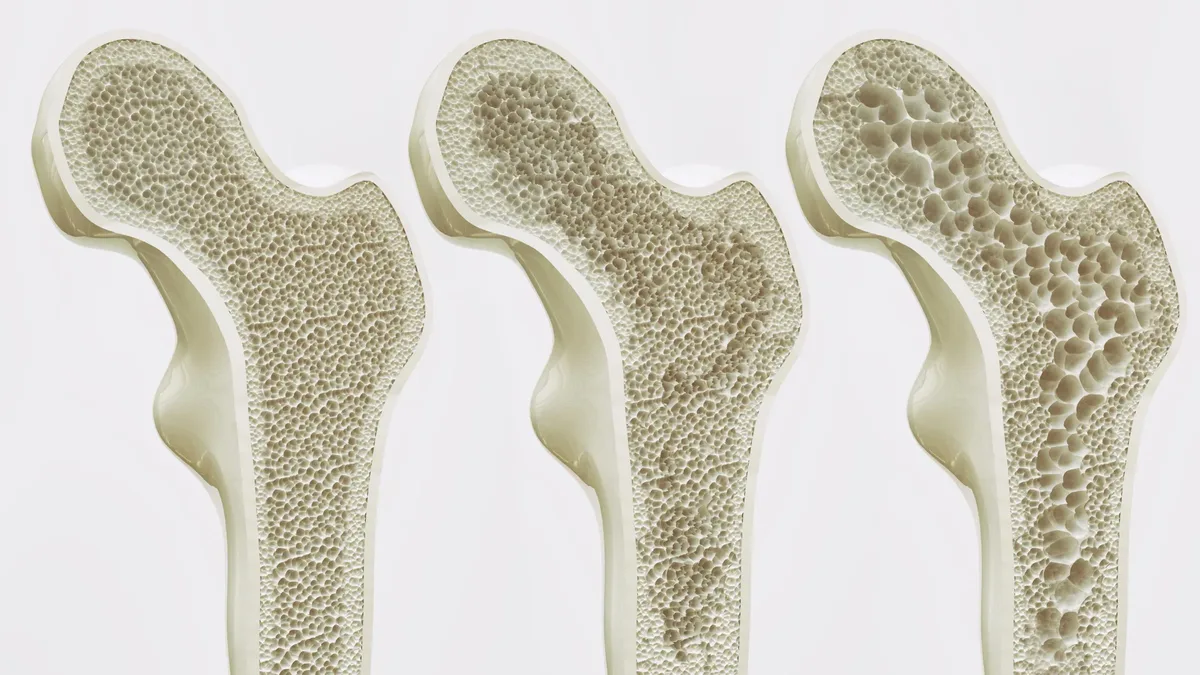 Scientists identify receptor GPR133 to boost bone density in mice