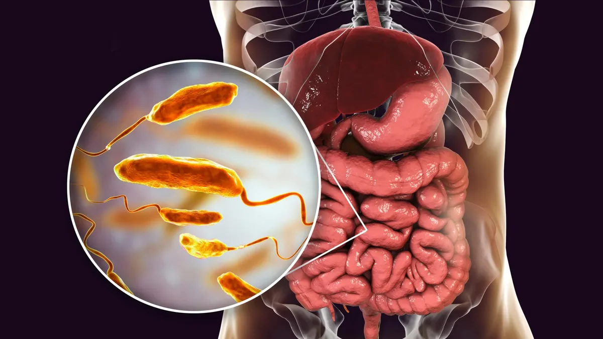 Study links protein-rich diet to 100-fold drop in cholera infections