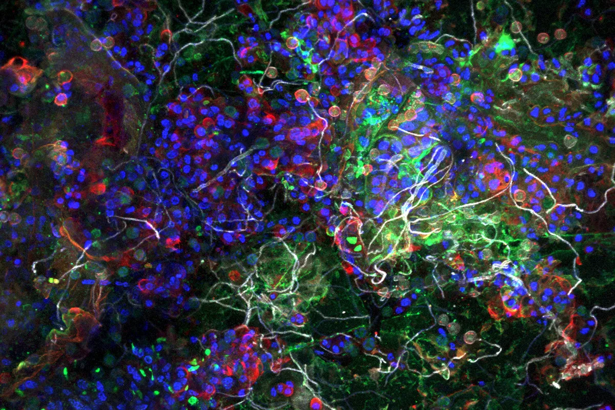 Researchers analyze plastisphere microbes as plastic pollution persists globally