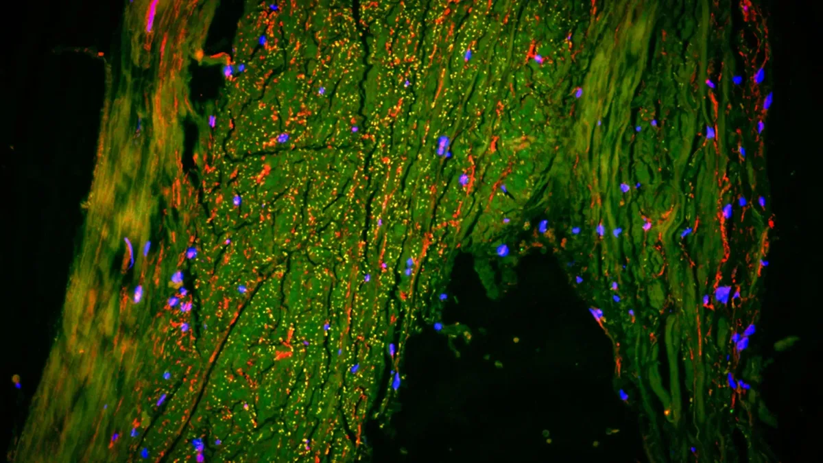 Researchers identify brain drainage pathway using MRI scans