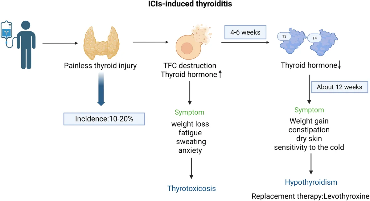 Polyclonal selection of immune checkpoint mutations in thyroid autoimmunity