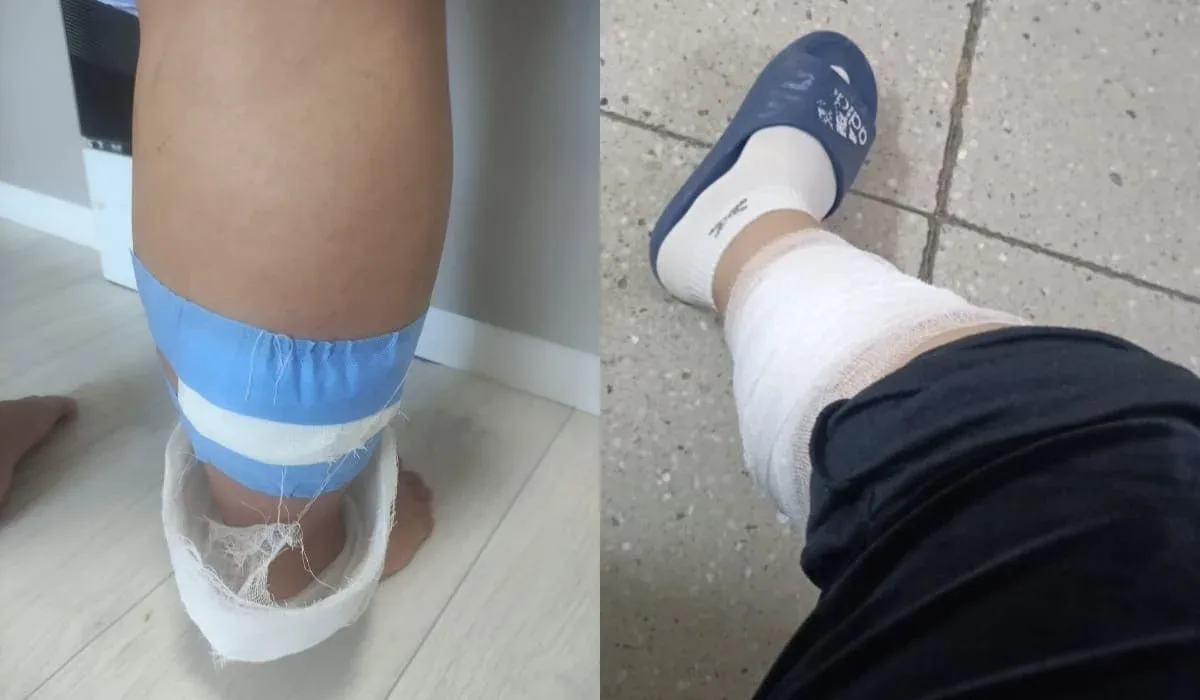 Стая собак напала на беременную женщину в Кокшетау