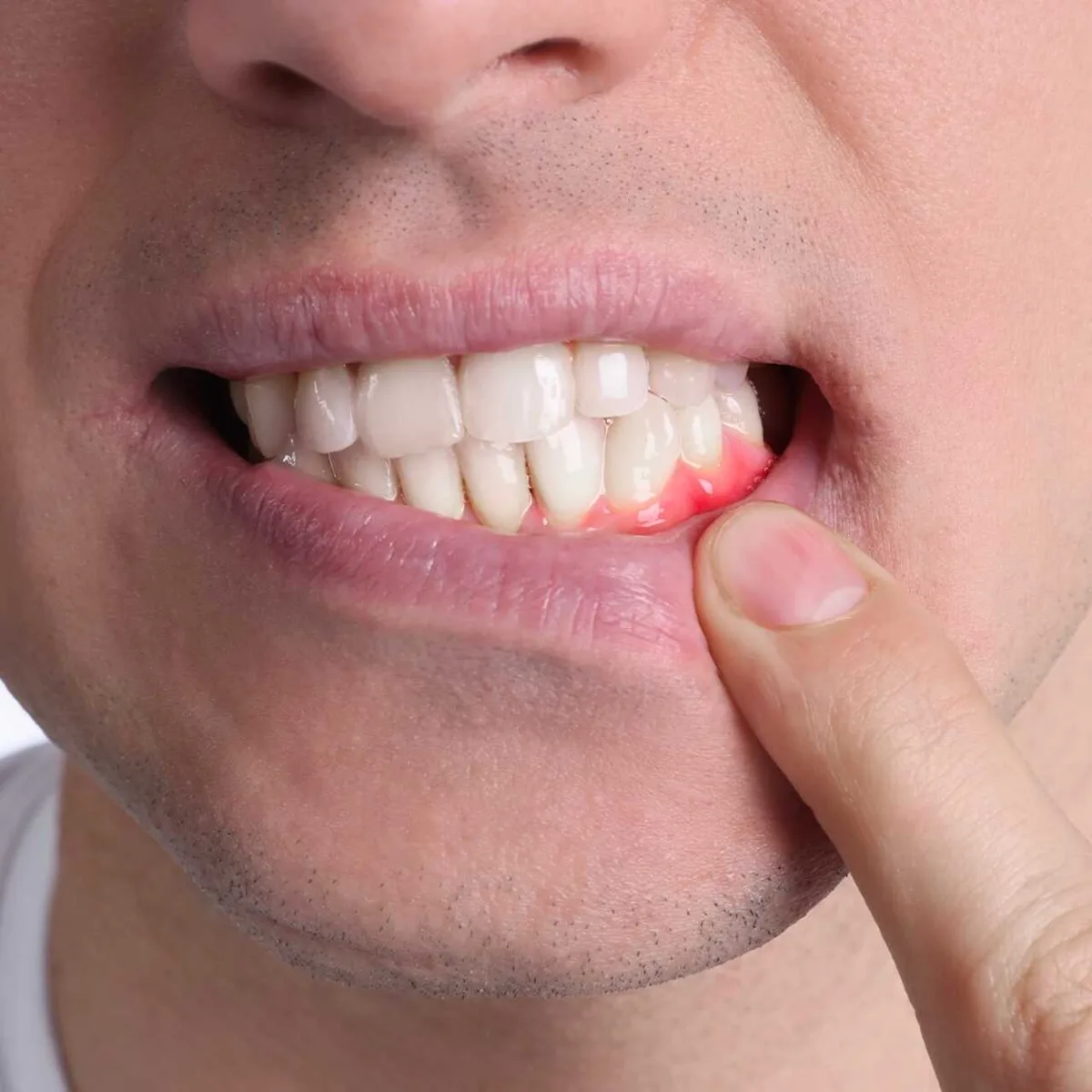 Почему десны стали чувствительными и что с этим делать