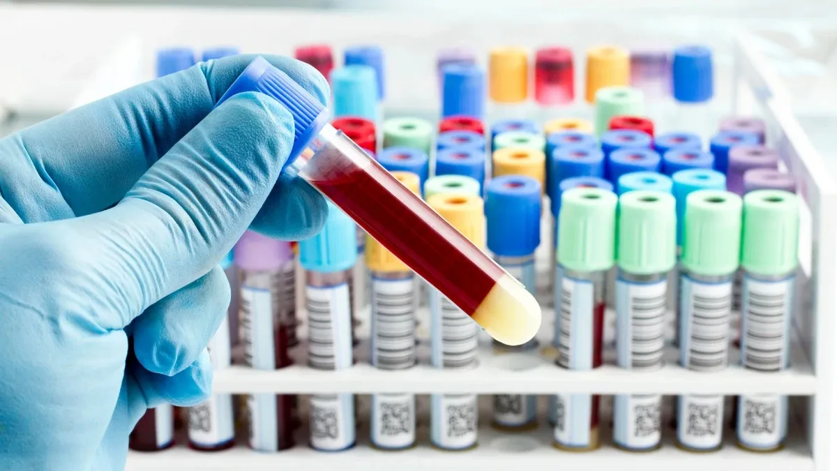 Blood test predicts Alzheimer's 10 years before symptoms