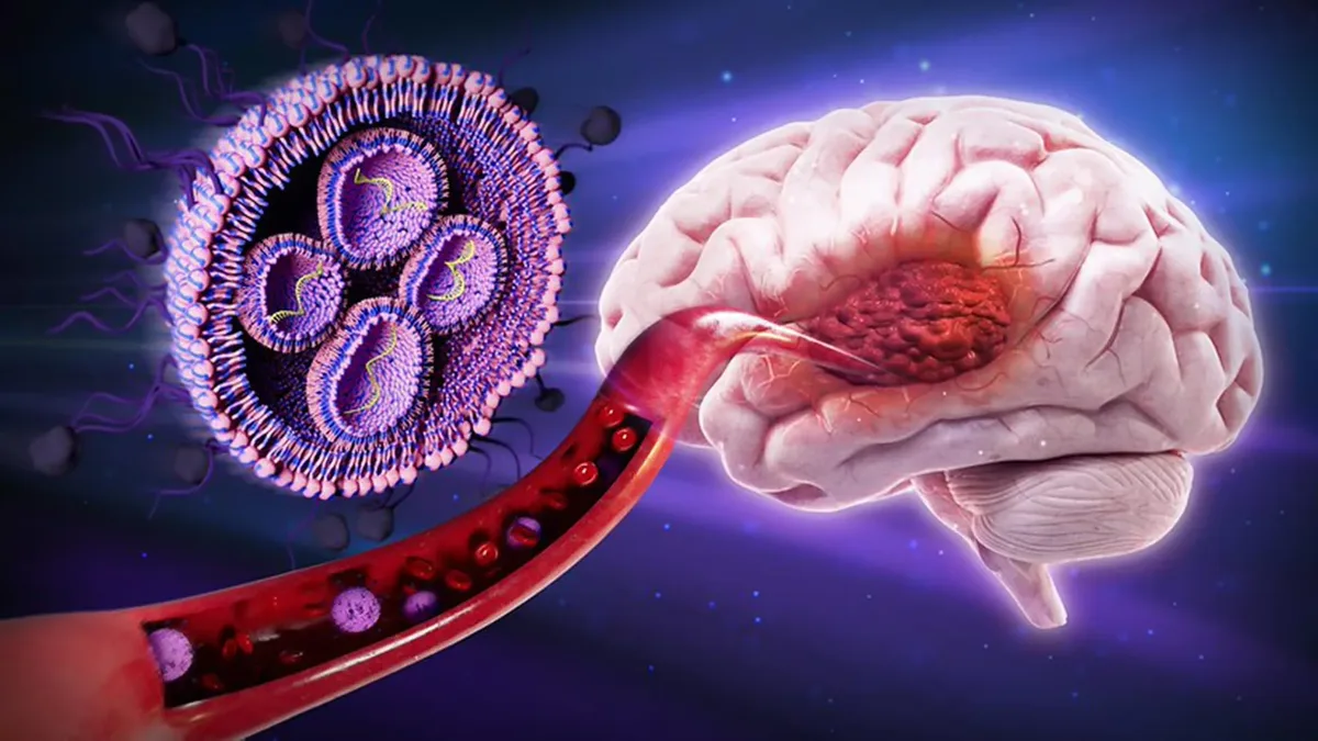 Sugar-coated nanoparticle therapy boosts brain cancer survival 50% in mice