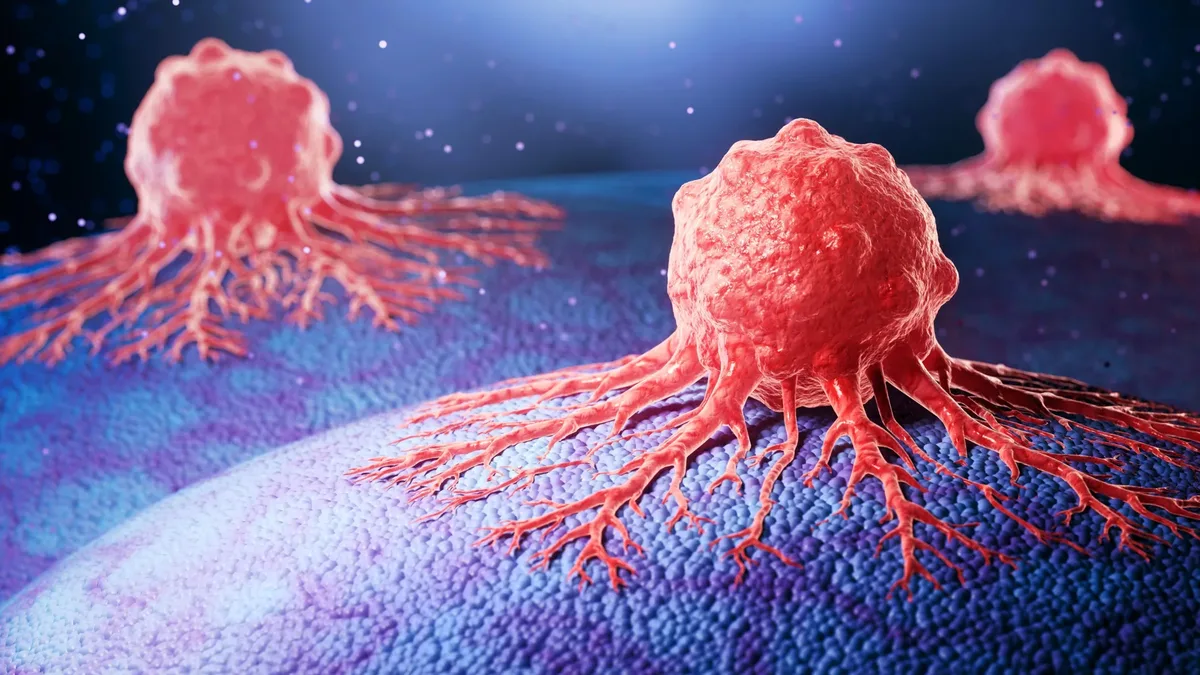 New antibody drug shows promise against aggressive prostate cancer